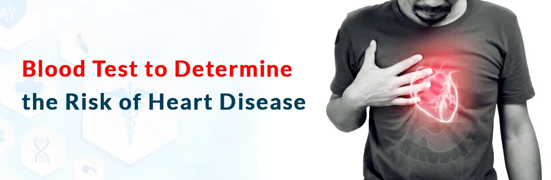 Blood Test to Determine the Risk of Heart Disease